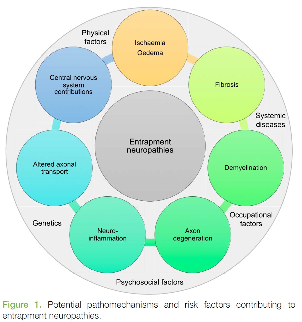 Lumbal skiveprolaps – Del 3: Skades nerven? Og hva er&nbsp;radikulopati?
